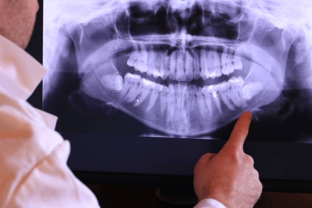 Best Emergency Dental Services for Seniors in Hudson, MI