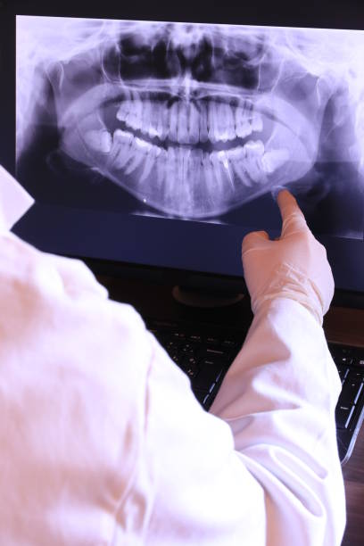 Best Emergency Dental Extractions in Hudson, MI