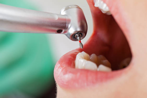 Best Emergency Dentist for Knocked-Out Tooth in Hudson, MI